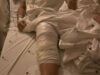 Idosa de 72 anos recebe prótese no joelho errado durante cirurgia em Curitiba